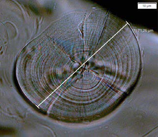 Bild des Otolithen eines jungen Herings, aufgenommen mit einem VS200 Scanner bei 40X