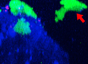Fig. 2: NK cell line KHYG-1 (green) changing shape while attacking and killing HT-29 tumor cells labeled with cetuximab (blue). PI uptake (red) indicates cell death. 9h