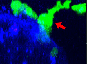 Fig. 2: NK cell line KHYG-1 (green) changing shape while attacking and killing HT-29 tumor cells labeled with cetuximab (blue). PI uptake (red) indicates cell death. 11h