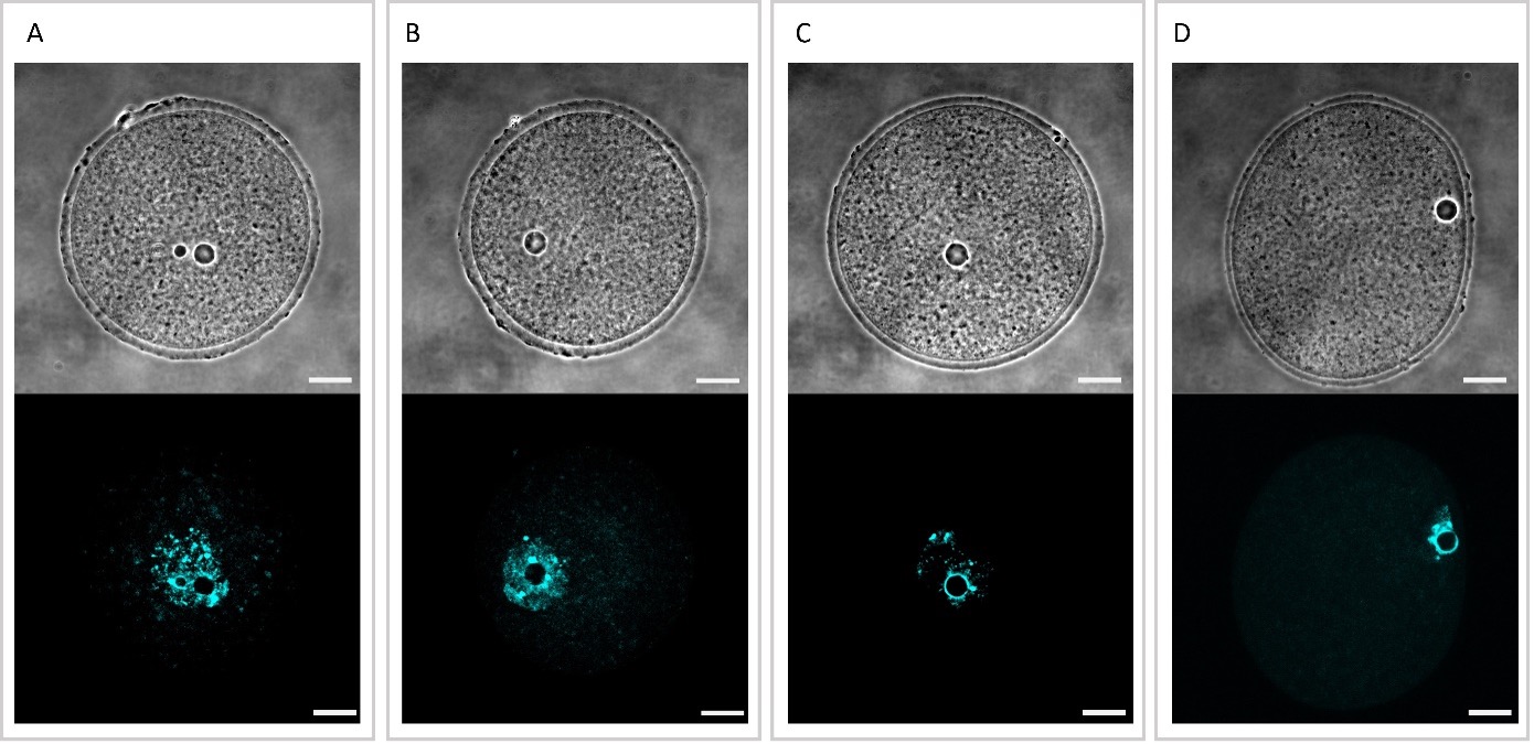 Examples of NSN and SN oocytes imaged in phase contrast (upper row) and fluorescence (lower row)