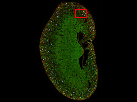 图8：利用TruAI（蓝色）预测小鼠肾脏切片上的肾小球位置。