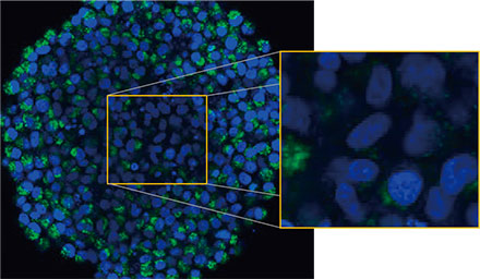 Figure 2 A and 2 B: EGFP-LC3-expressing HeLa cell spheroids (A) in normal condition and (B) treated with CQ. The enlarged images show the yellow rectangle region of the original spheroid images.