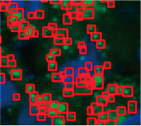 Figura 2 C à esquerda: A imagem original das células no esferoide com CQ. À direita: A mesma imagem com reconhecimento de objeto para pontos (retângulos vermelhos).