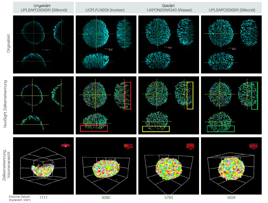 ​Abb. 3. Auswirkungen der Sphäroid-Klärung und der Objektivauswahl auf die 3D-Zellzählung.