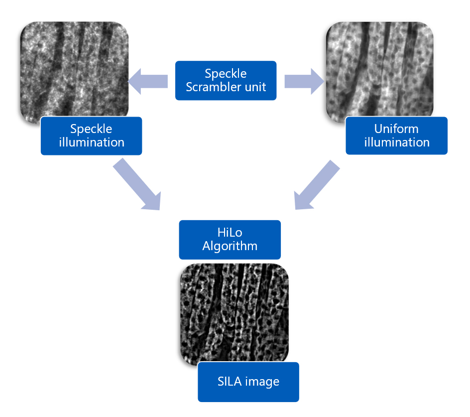 SILA image acquisition for whole slide imaging of thick samples