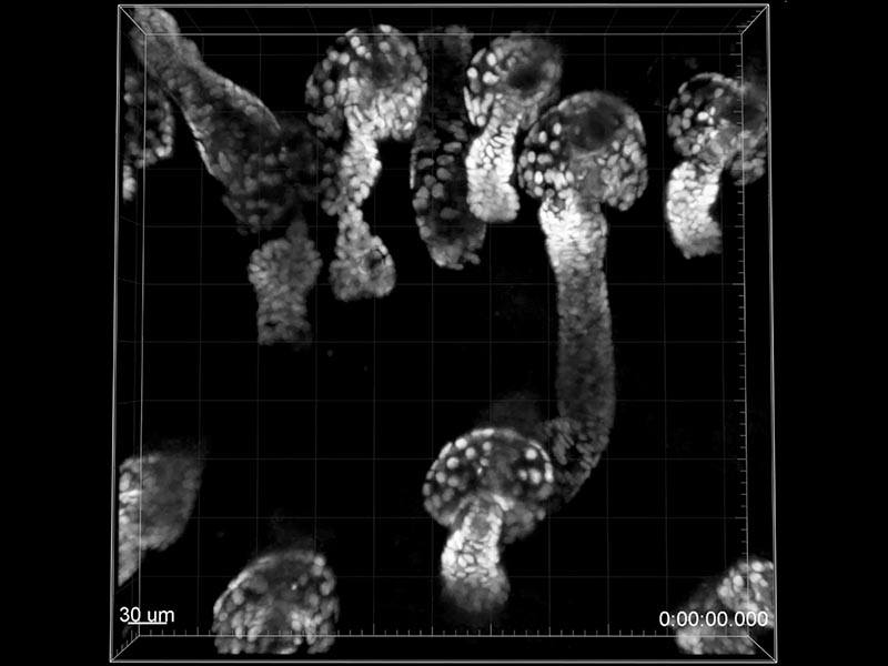 コロラド大学ボルダー校で、FVMPE-RS™多光子励起レーザー走査型顕微鏡を使用してイメージングした取り込んだ画像。