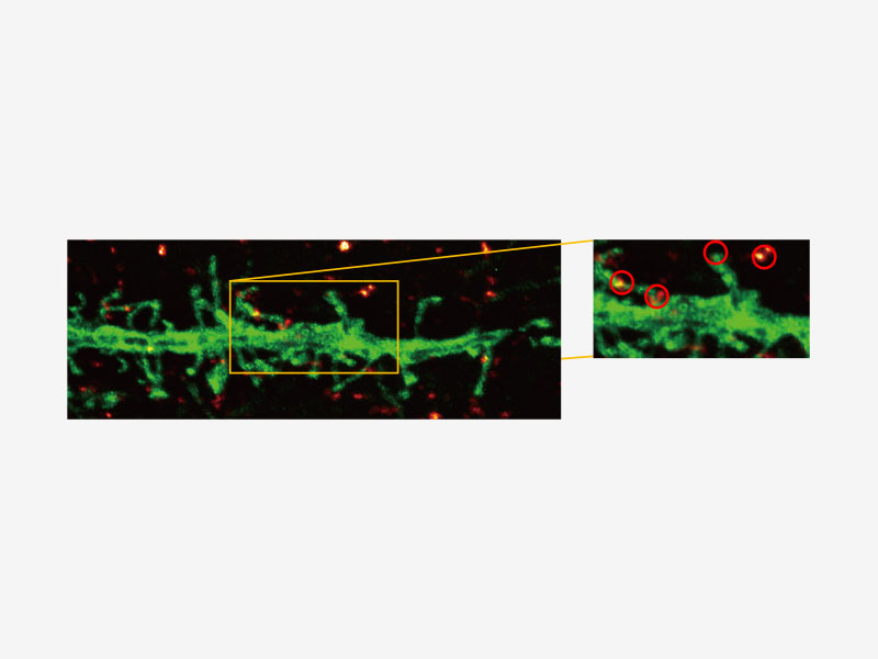 奥林巴斯超高分辨OSR图像，可清晰区分点状染色。
