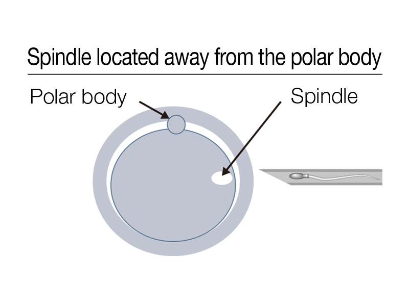 Spindle located away from the polar body