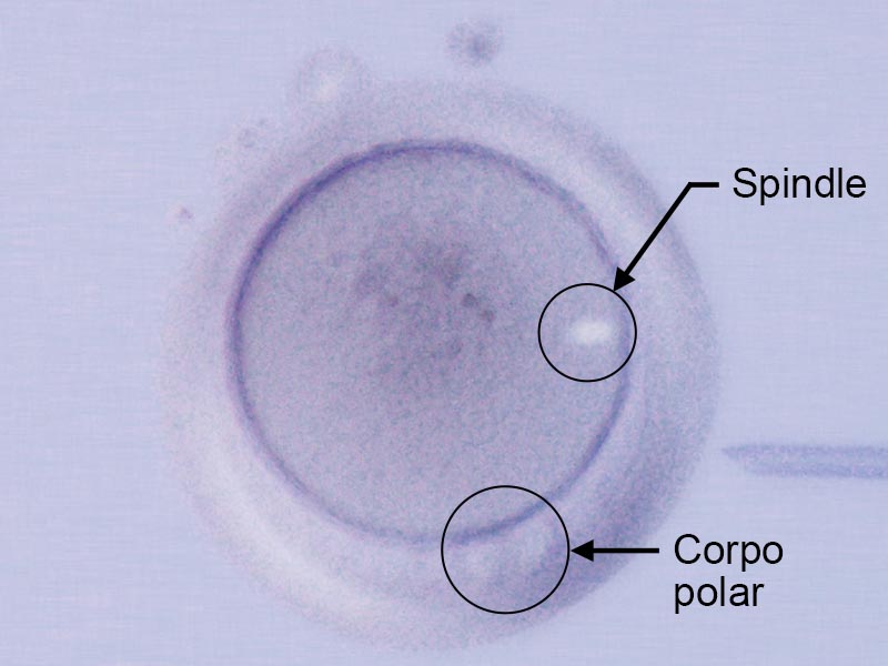 Spindle / Corpo polar