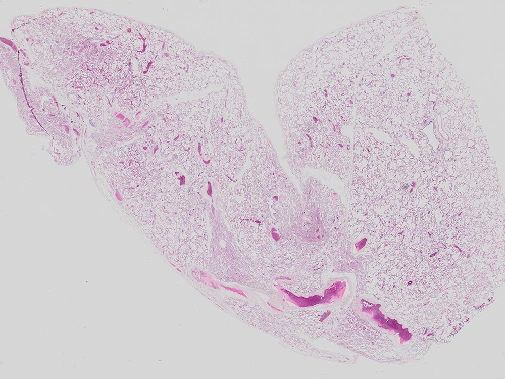 マウス肺の貼り合わせ画像（染色：HE、UPLXAPO20Xで撮影）