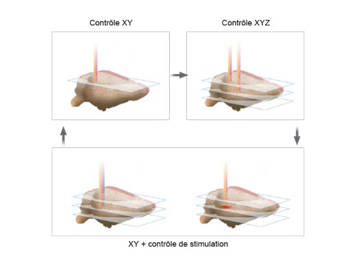 Synchronisation en microsecondes pour l’électrophysiologie et l’optogénétique