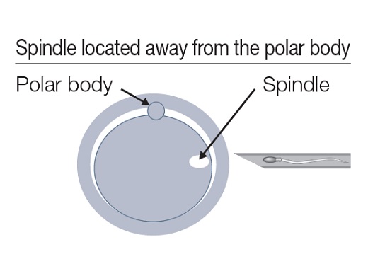 Image of polar body and spindle