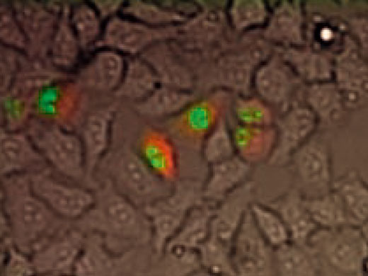 核局在GFPと細胞質内ルシフェラーゼの検出 (明視野画像との重ね合わせ。GFPを緑、ルシフェラーゼを赤で表示)
