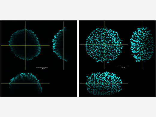  Image and Analyze Inside Spheroids