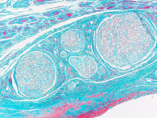 Bright field image of bone and cartilage captured in color mode.