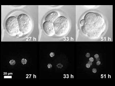 Procesamiento de imágenes de células vivas