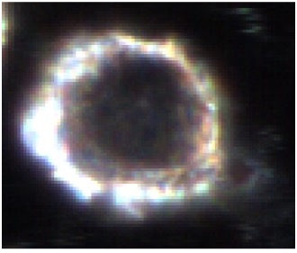 Imagen microscópica de campo oscuro aumentado de células de macrófagos