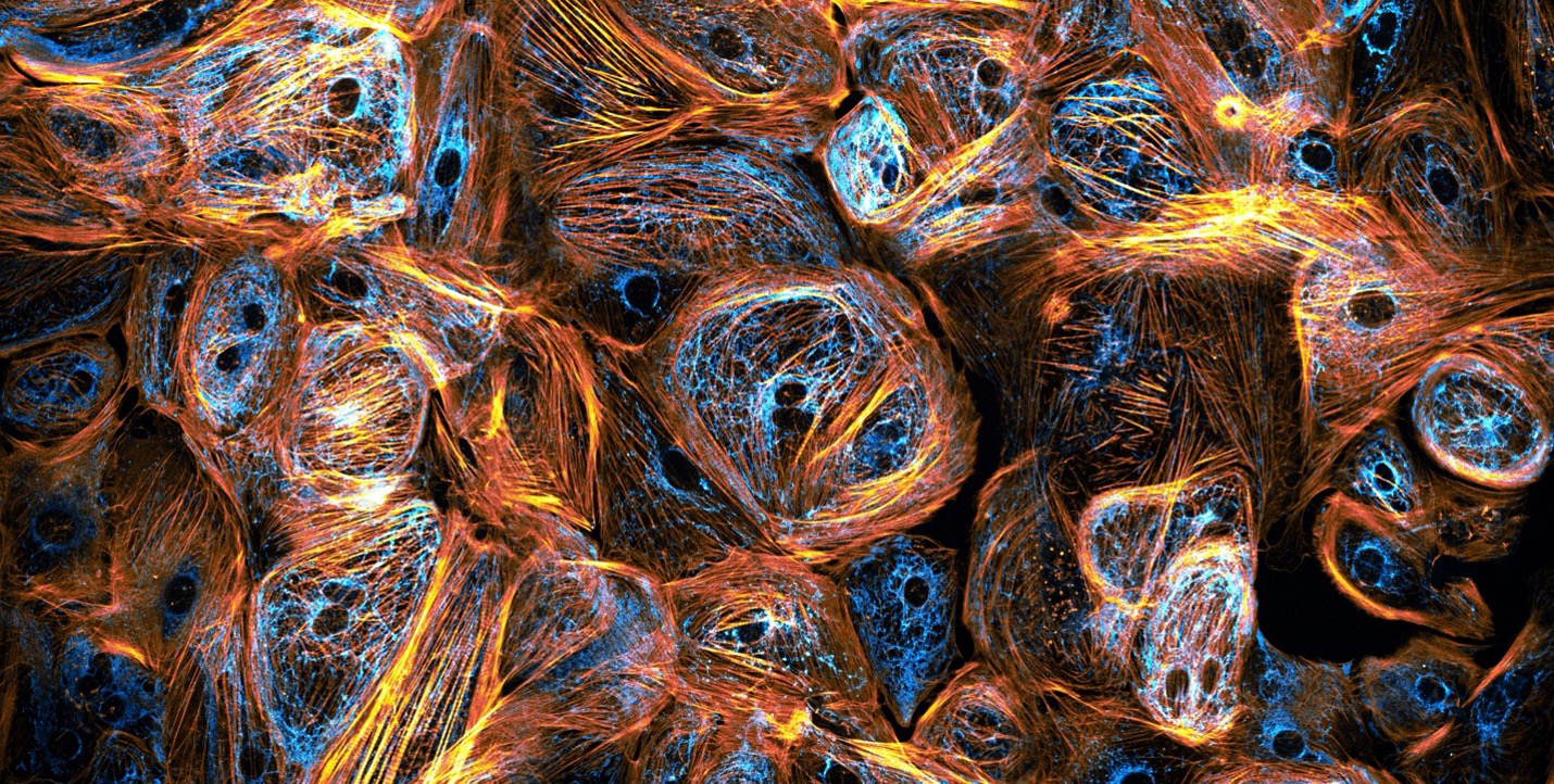 Captured by Till Stephan (Germany). Heart cells derived from induced pluripotent stem cells.  