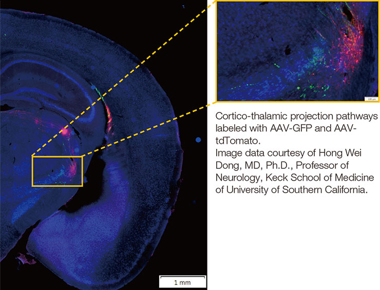 Zoom du scanner de lames VS200 sur une image du cerveau