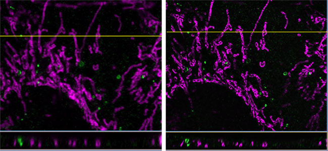 オートファジー誘導条件でPFA固定したマウス胚性線維芽細胞におけるオートファゴソーム形成因子WIPI2とミトコンドリア外膜タンパク質TOM20