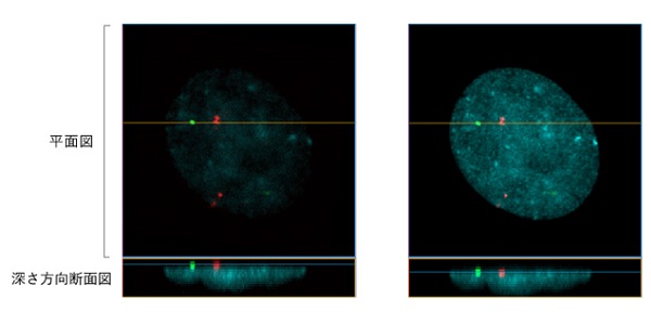 共焦点レーザー顕微鏡によるHeLa細胞核内の染色体検出画像の比較
