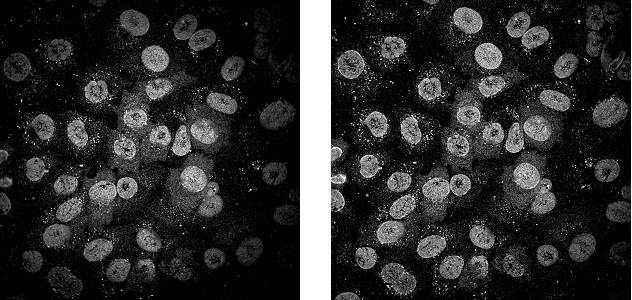 スピニングディスク型共焦点超解像顕微鏡「SpinSR10」共焦点モードによる核膜孔複合体画像比較