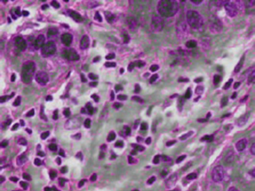 染色した病理組織標本の観察画像　右：フォーカスピーキング機能使用時