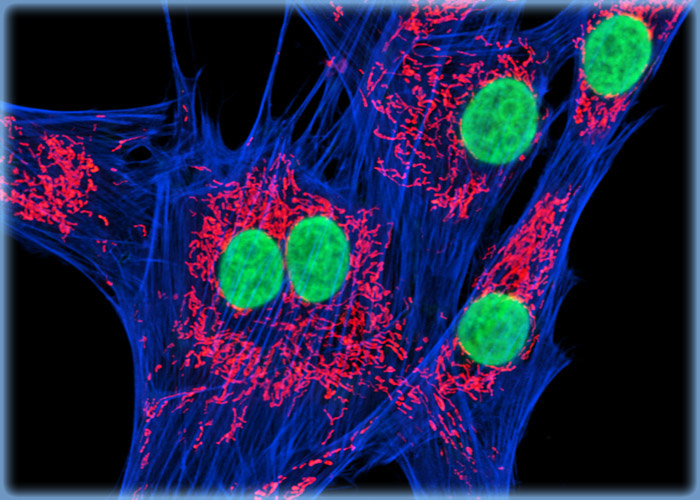 Raccoon Uterus Fibroblast Cells with BODIPY FL, MitoTracker Orange CMTMRos, and DRAQ5