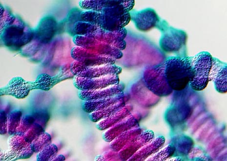 Jellyfish Sensory Organs (Aurelia Tentaculocysts)