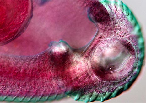 Digenetic Trematode (Echinostoma)