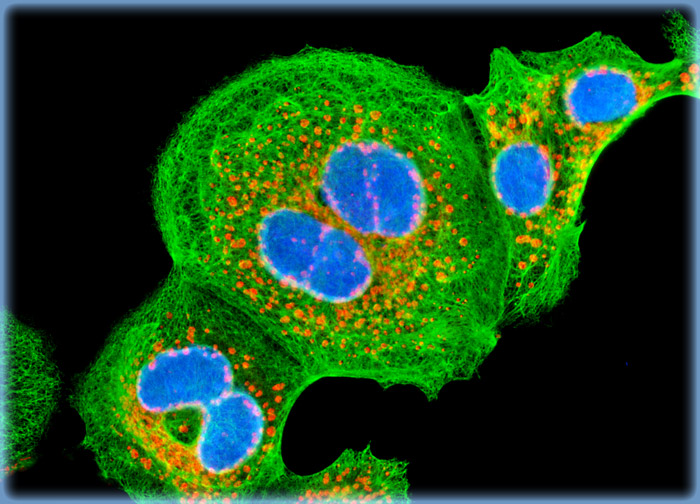 Madin-Darby Canine Kidney Epithelial Cells (MDCK Line)