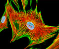 Fluorescence Digital Image Gallery - Fibroblast Cells | Olympus LS