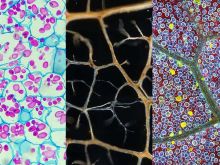 Plankton to Plants—Our Most Popular Microscope Images for August 2022