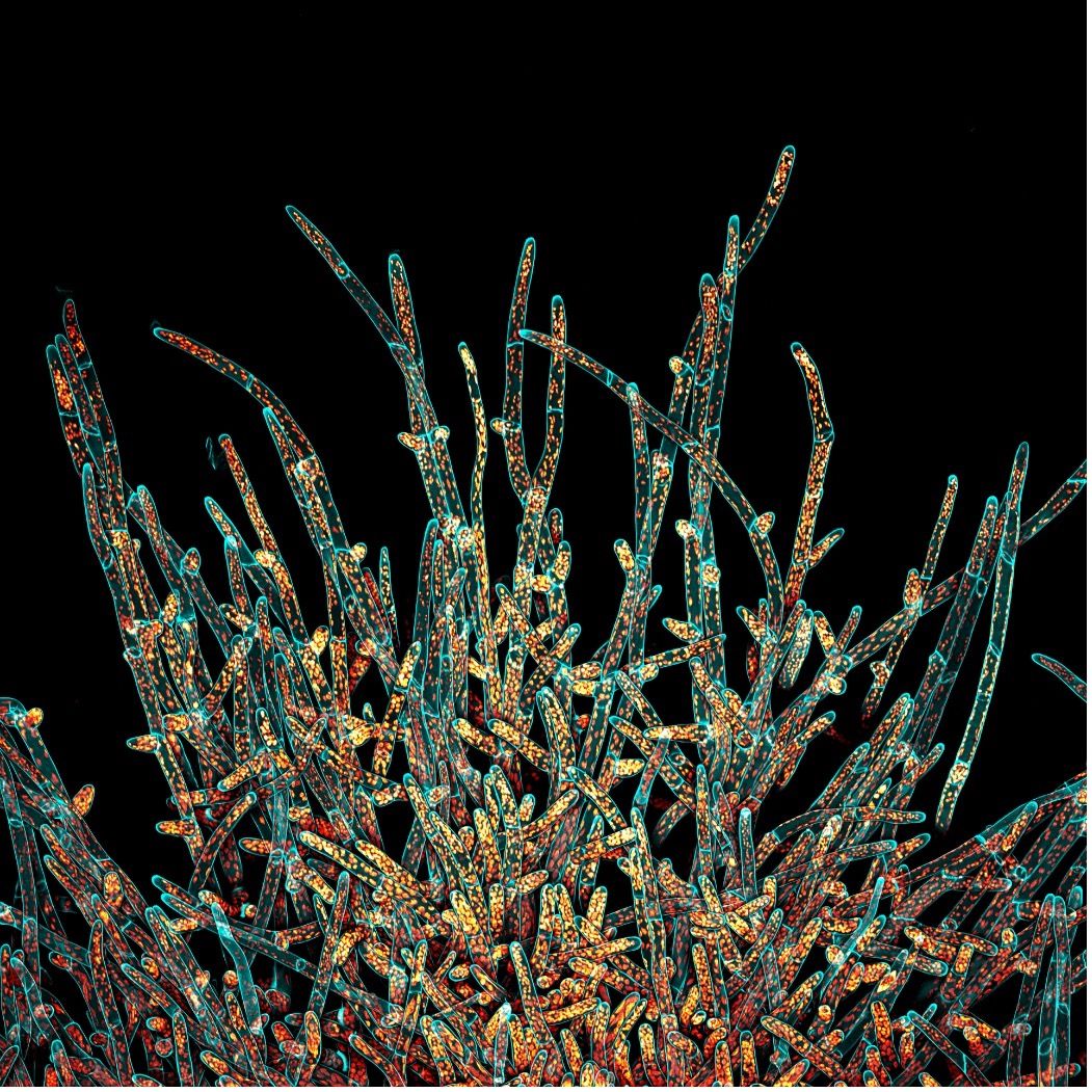 Microscope deconvolved Z-stack image of moss Physcomitrium patens protonemal cells