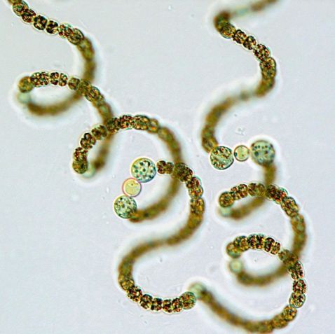 Plankton-Cyanobakterien