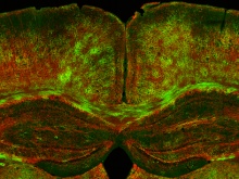 Spinning-Disk Confocal Microscopy Advances Brain Myelin Research for Alzheimer's Disease