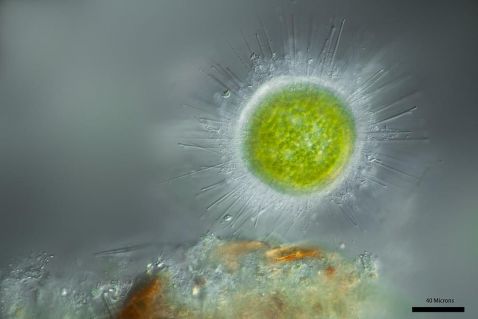 Acanthocystis turfacea chlorella virus 1