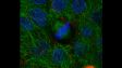 SpinSR10: célula epitelial de cultura miótica. (Cromossomo: azul; tubulina: verde; ZO1: vermelho)