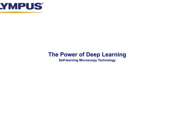 The Power of Deep Learning: Self-learning Microscopy Technology ...