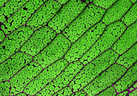 Moss gametophore leaf cells under the microscope