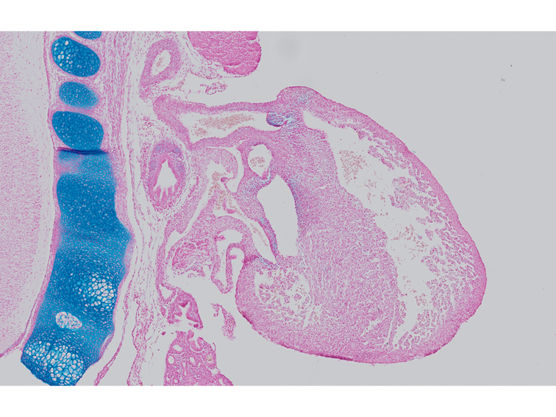 Imagem de aplicação de embrião de camundongo E15.5 tingido com azul alciano e vermelho rápido nuclear