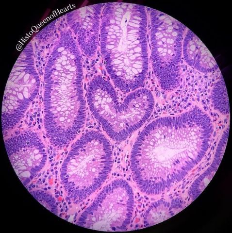 Human colon under a microscope