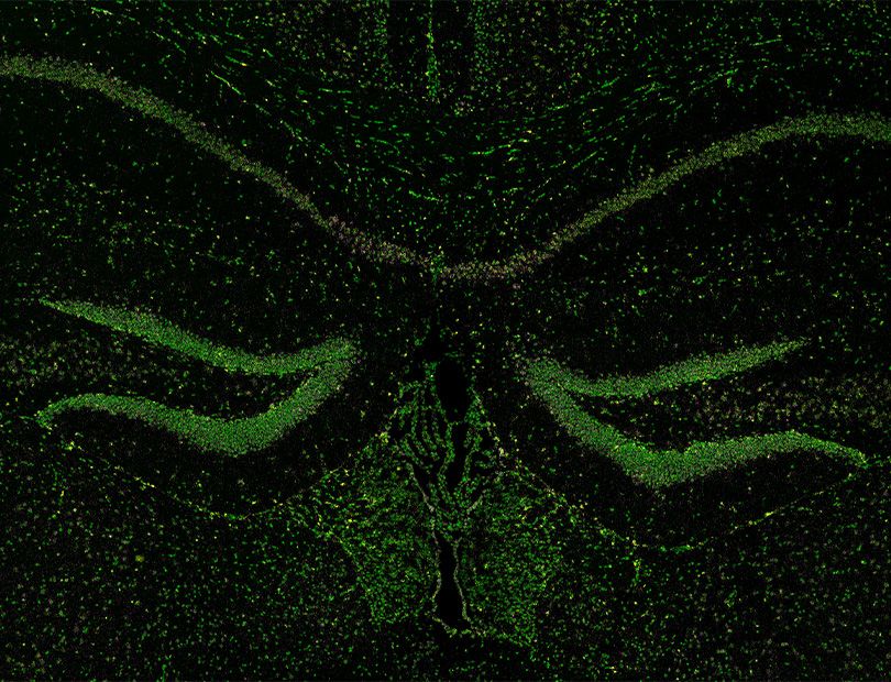Fluorescence image of RNA molecules in a mouse brain section