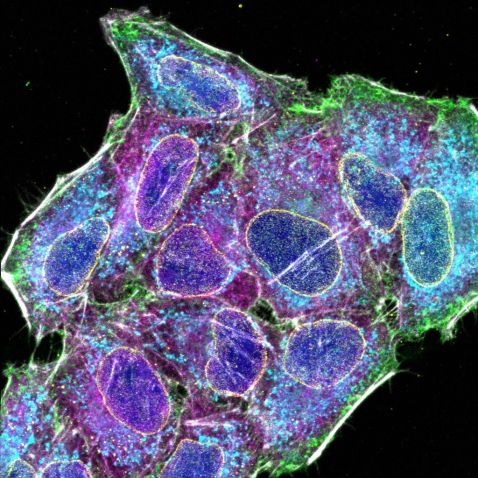 人宫颈癌传代细胞的多路传输图像