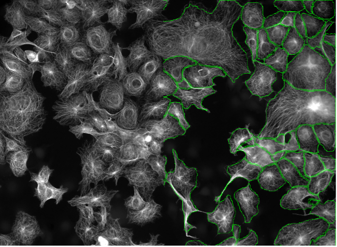 Deep learning image segmentation of huFIB cells