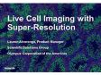 Live Cell Imaging with Super-Resolution