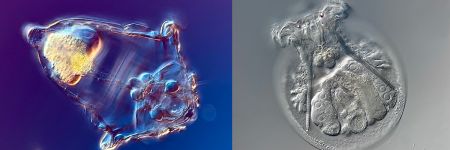 Rotíferos Synchaeta sp. e Testudinella patina sob o microscópio