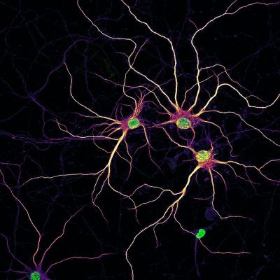 Image of primary rat cortical neurons at 14 days in vitro with nuclei (green) and developing dendrites (mpl-inferno LUT) with MAP2 staining added to visualize outlines of neurons 