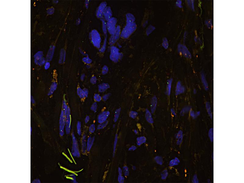 Fluorescence in-situ hybridization (FISH) sample