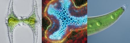 Algae images under a microscope